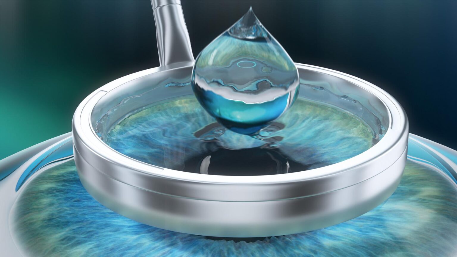 Hamburg Augen lasern zentrumsehstaerke PRK